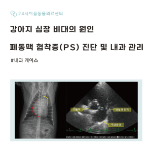 [케이스 리포트] 청색증을 유발한 폐동맥 협착증(PS) 증례: 내과적 상…